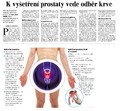 K vyšetření prostaty vede odběr krve